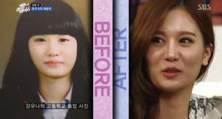 Illustration for article titled Depressing? Inspirational? Reverse Plastic Surgery Show Hits Korea
